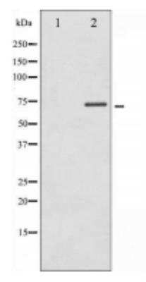 Western Blot: p70 S6 Kinase/S6K [p Thr389/412] Antibody [NB600-1049]